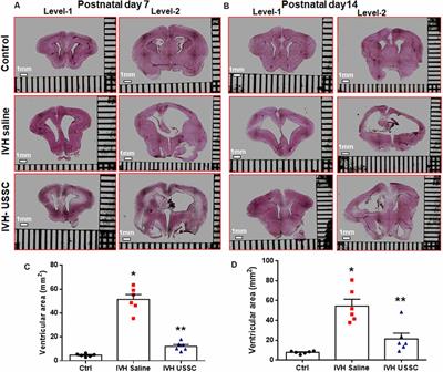 Human Cord Blood Derived Unrestricted Somatic Stem Cells Restore Aquaporin Channel Expression, Reduce Inflammation and Inhibit the Development of Hydrocephalus After Experimentally Induced Perinatal Intraventricular Hemorrhage